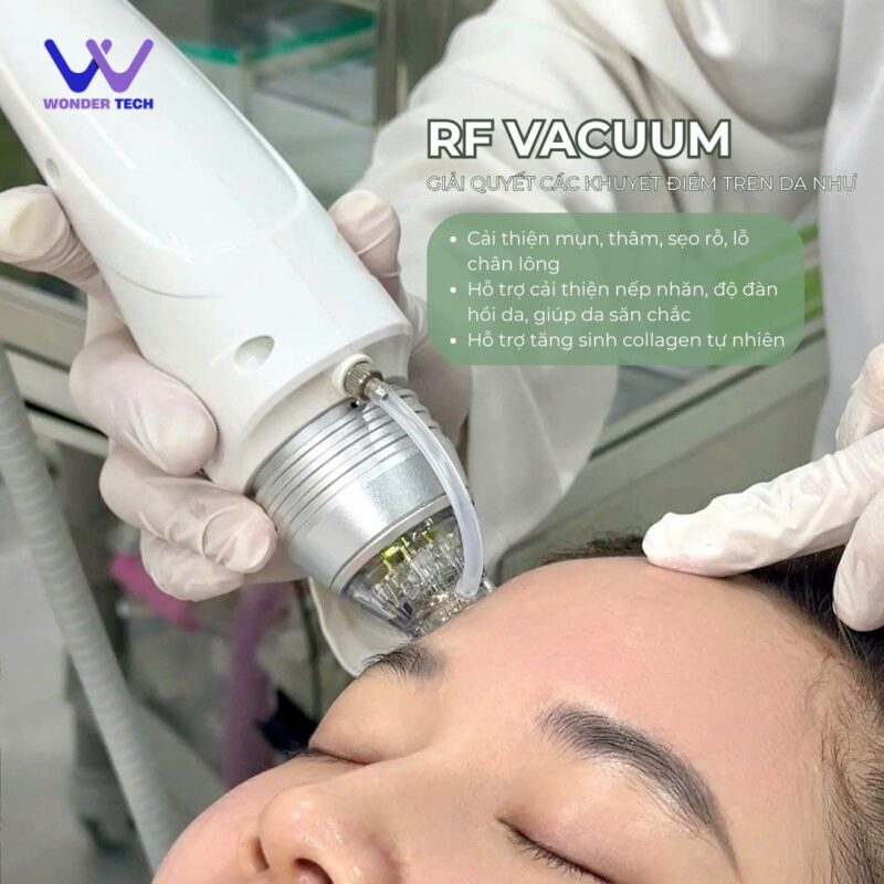 Ảnh minh họa Công nghệ Vi kim RF NEEDLE VACUUM